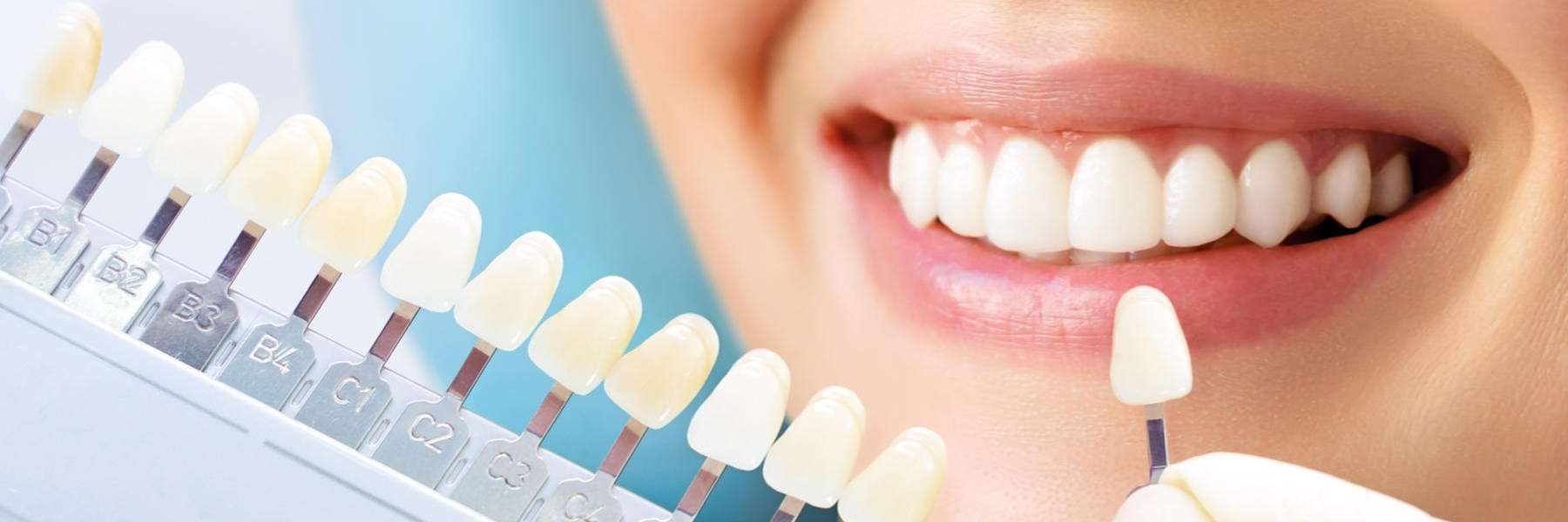 Teeth Whitening | Dentist