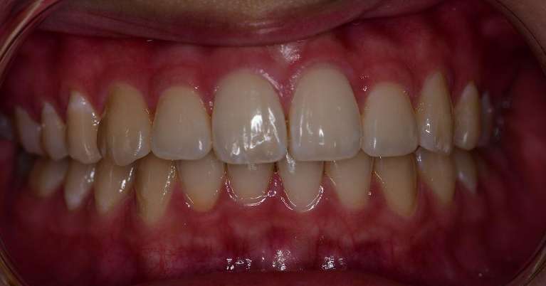 Orthodontics-After-Image